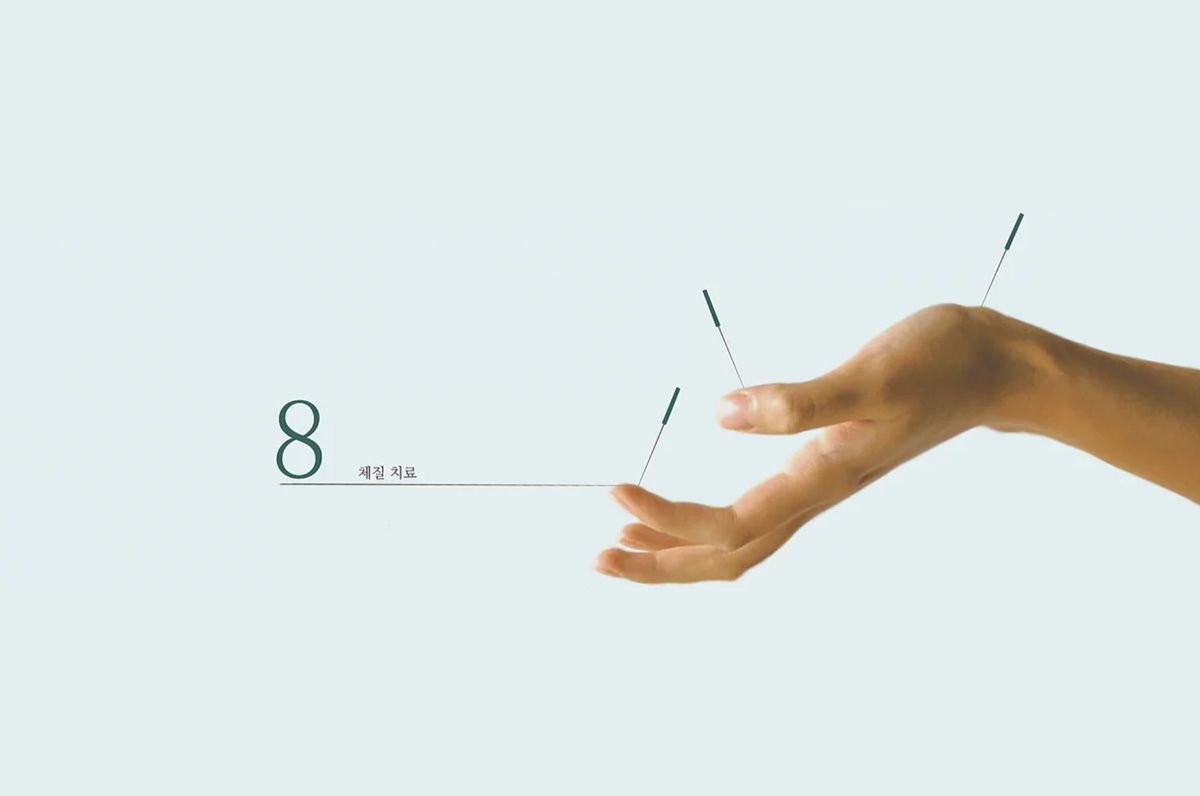 acupuntura coreana de 8 constituciones, tratamiento de acupuntura personalizado